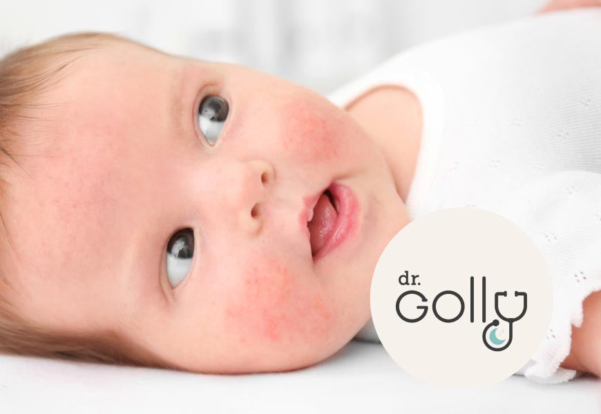 Golly Blog Baby eczema tips from Dr Golly – ergopouch US